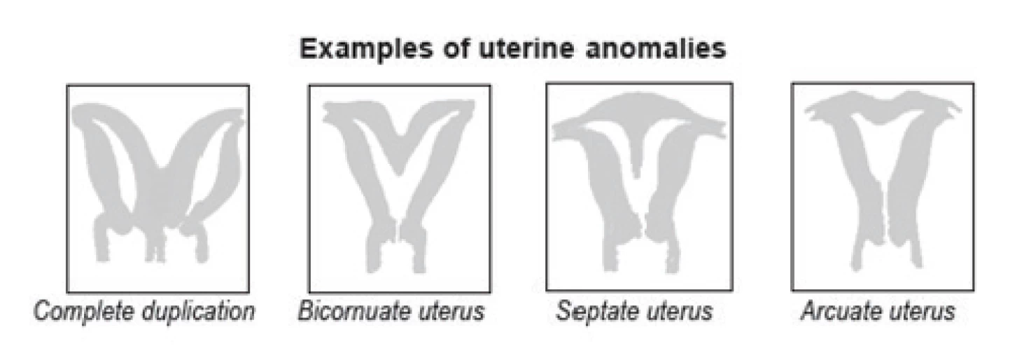 fig2-abnormalities.webp