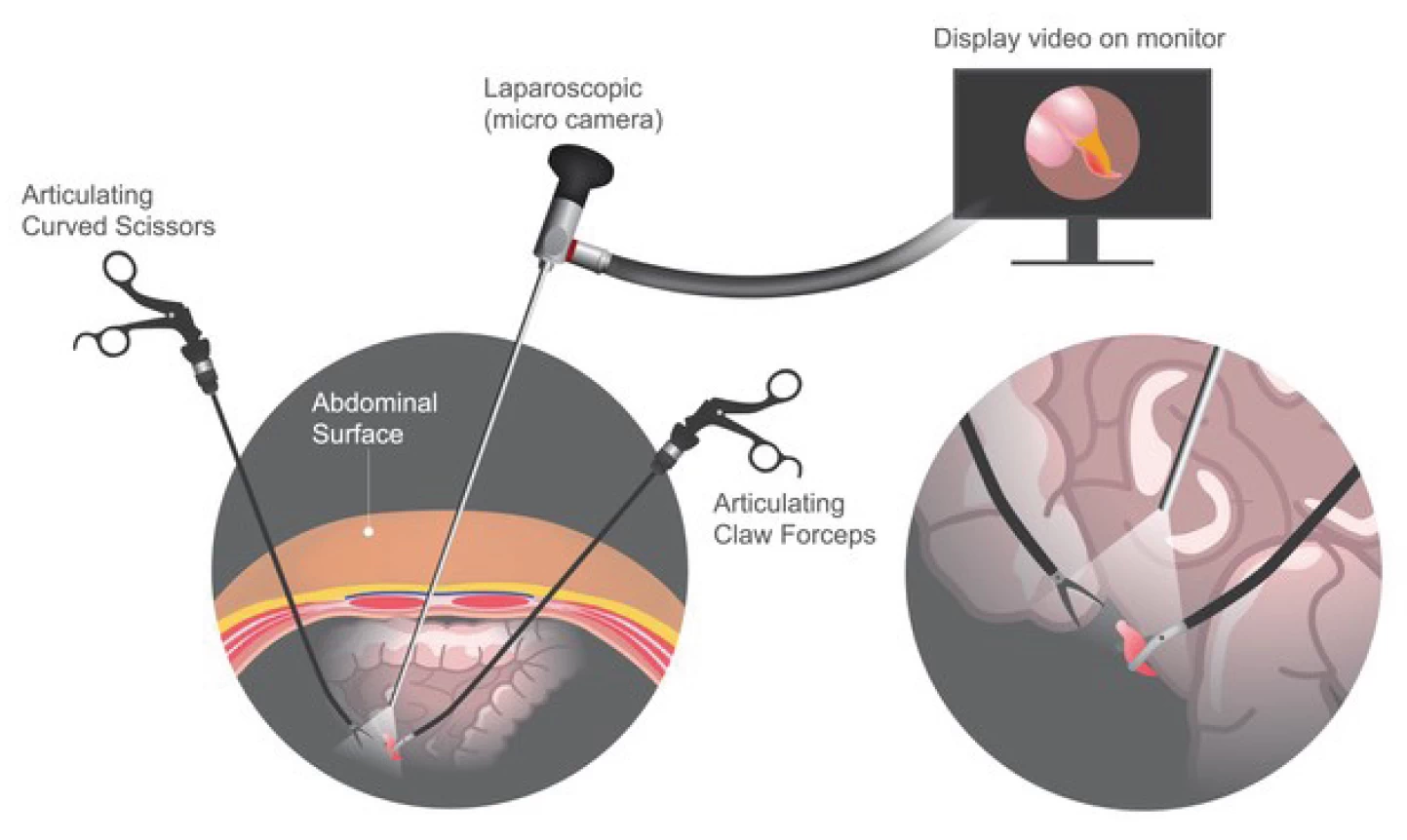 fig1-conditions-surgery.webp