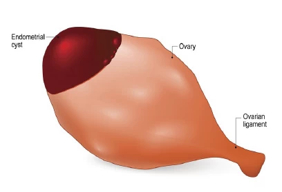 fig3-conditions-surgery.webp