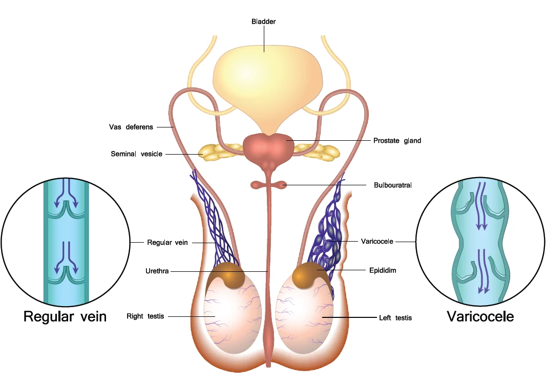 fig1-male-fertility.webp