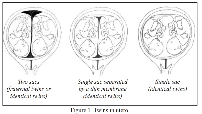 fig1-multiple-pregnancy.webp