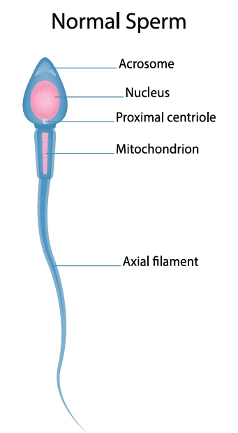 fig1-sperm-morphology.webp