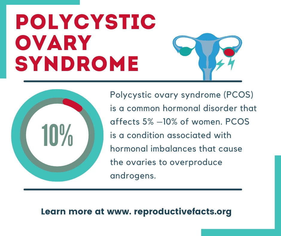 PCOS Treatment  5.webp